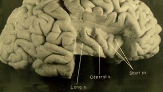 New Photos of Einstein’s Brain