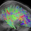 Mapping the Brain