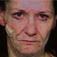 Many 'Faces of Meth'