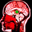 The Electric Brain