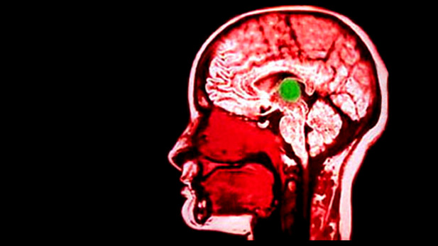 The Electric Brain
