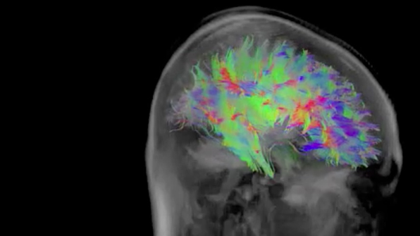 Mapping the Brain